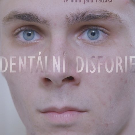 Dentální disforie