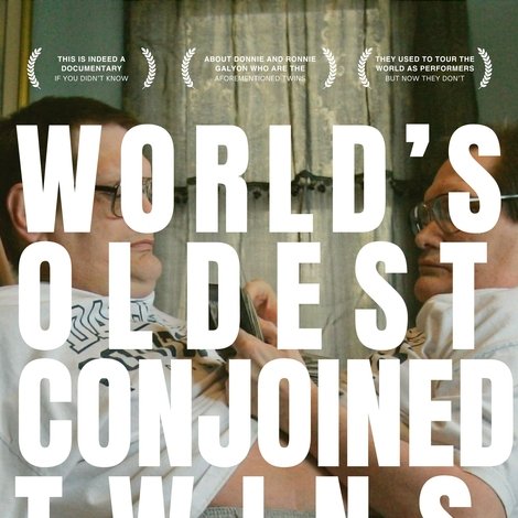 The World's Oldest Conjoined Twins