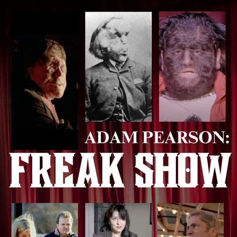 Adam Pearson: Freak Show