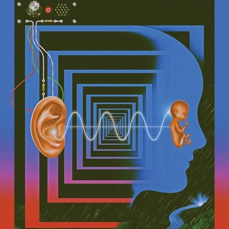Ultrasound