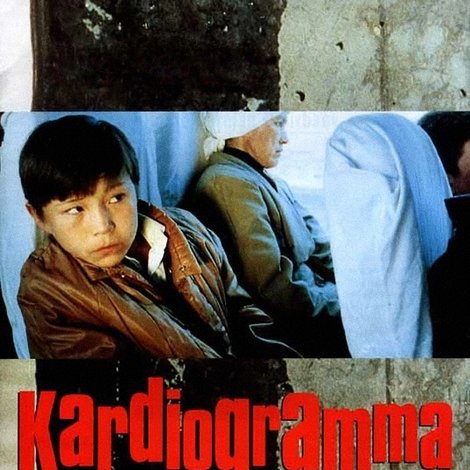 Кардиограмма
