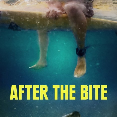 After the Bite