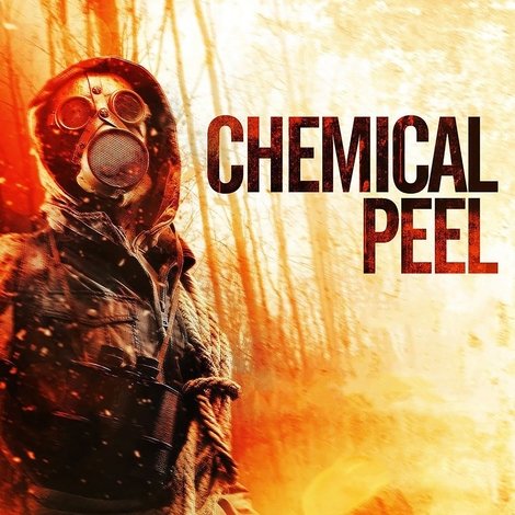 Chemical Peel