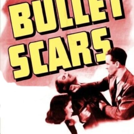 Bullet Scars