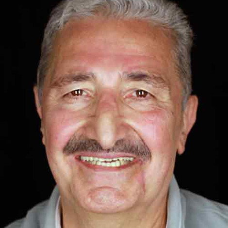 Yaşar Güner