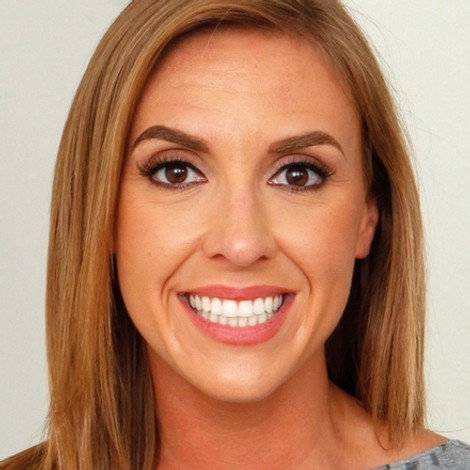 Kate Linn
