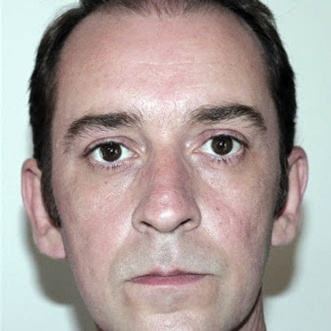 Gérald Raynaud