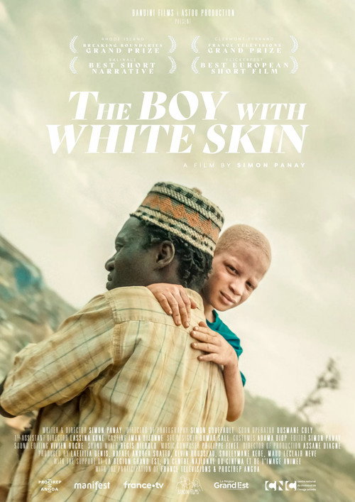 The Boy with White Skin Poster