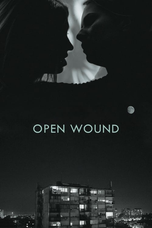 Open+Wound