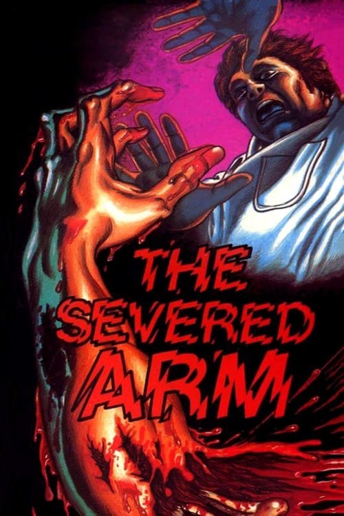 The+Severed+Arm
