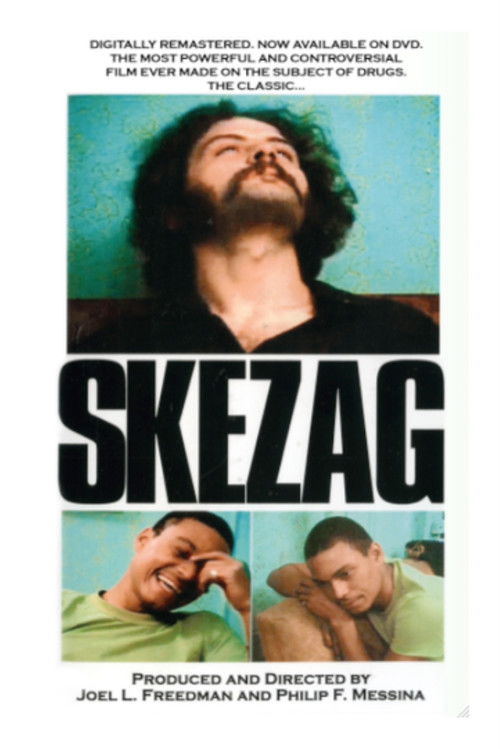 Skezag