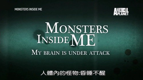 My Brain Is Under Attack
