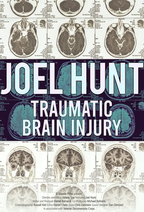 Joel+Hunt%3A+Traumatic+Brain+Injury+%28TBI%29