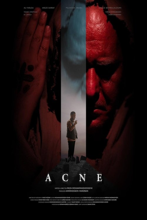 Acne Poster