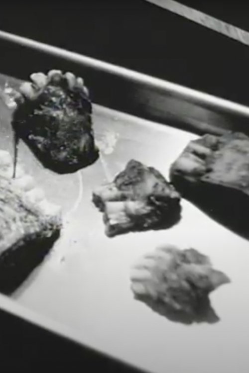 A Primer for Dental Extraction