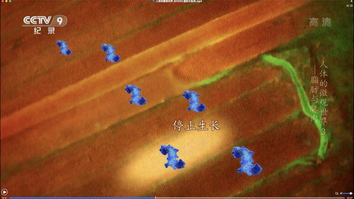人体的微观世界第1季第3集