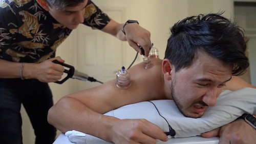 The Bad Kind of Cupping :|