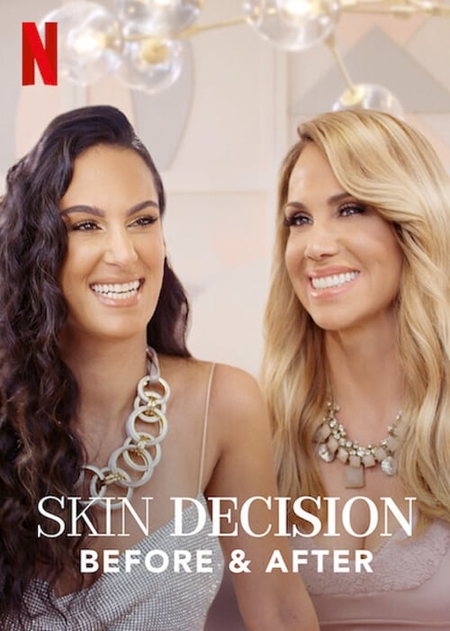 Skin decision: prima e dopo