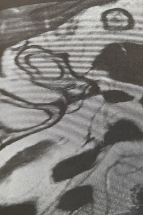 Cold Water