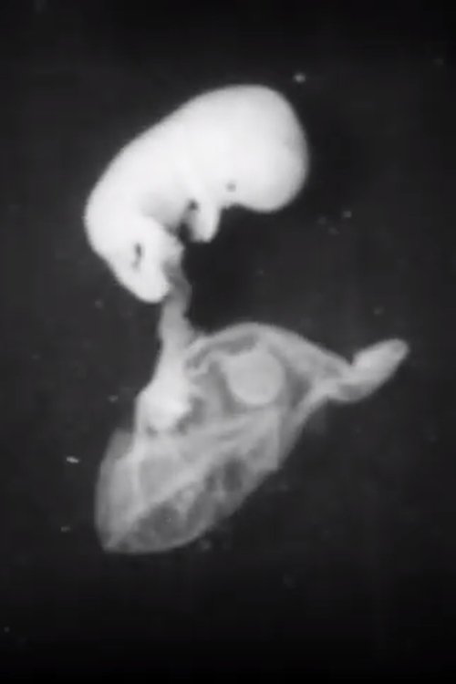 Early Human Fetal Activity poster