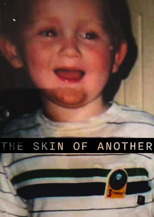 The Skin Of Another