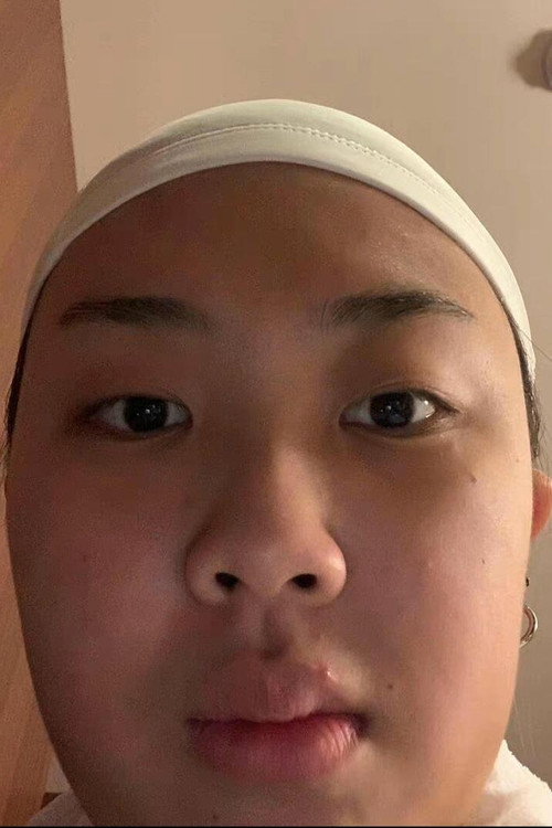이영지