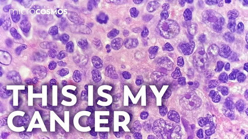 How Do We Find Cancer?