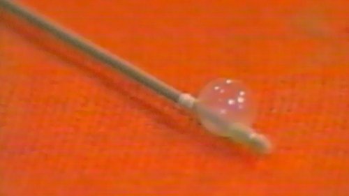 Image de l'épisode 86