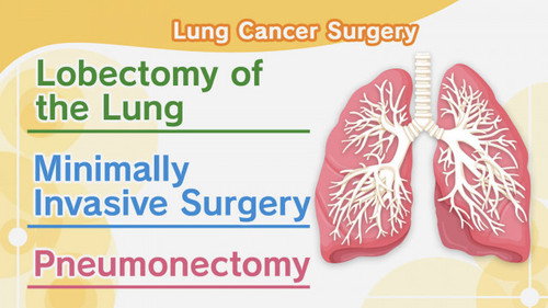 Lung Cancer #3: Surgery