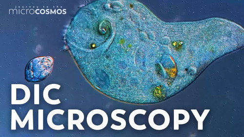 We Upgraded Our Microscope!