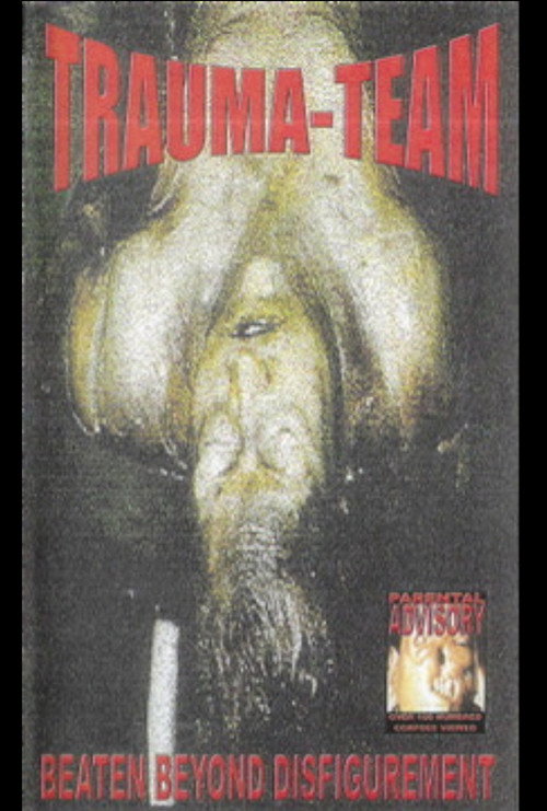 Trauma-Team! - Beaten Beyond Disfugurement