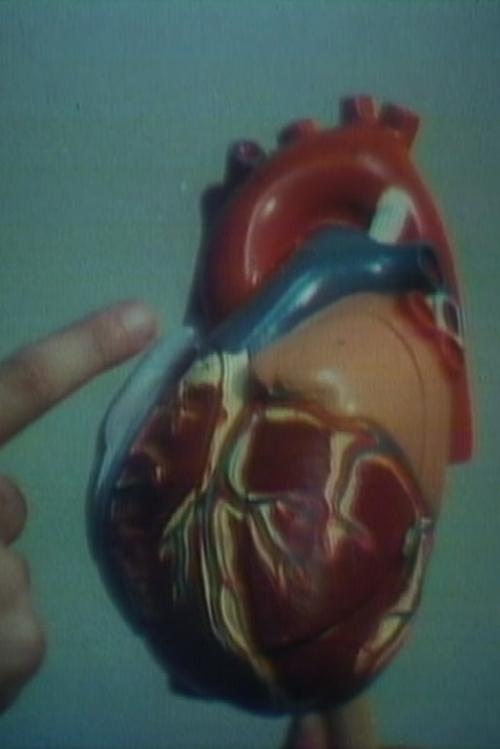 Open Heart Surgery (1975)