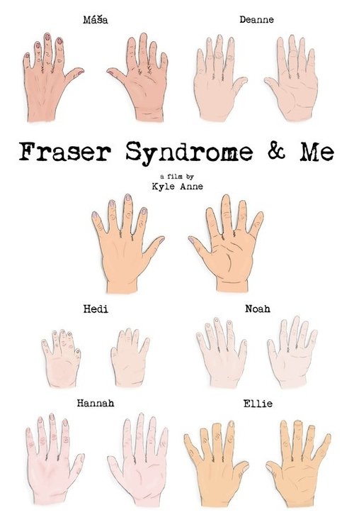 Fraser Syndrome & Me