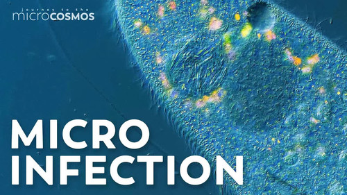 Our Paramecia Are Infected