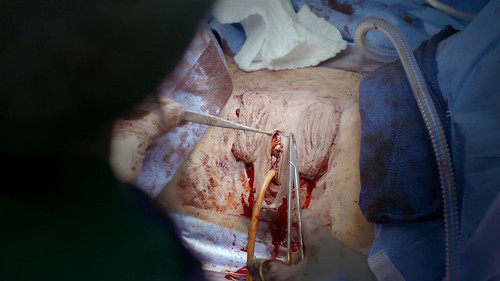 地平线系列：跨性别者