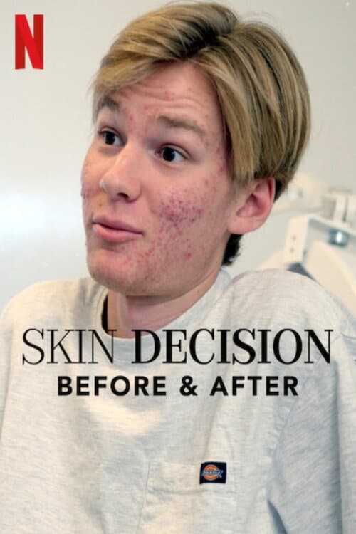 Skin Decision: Before and After