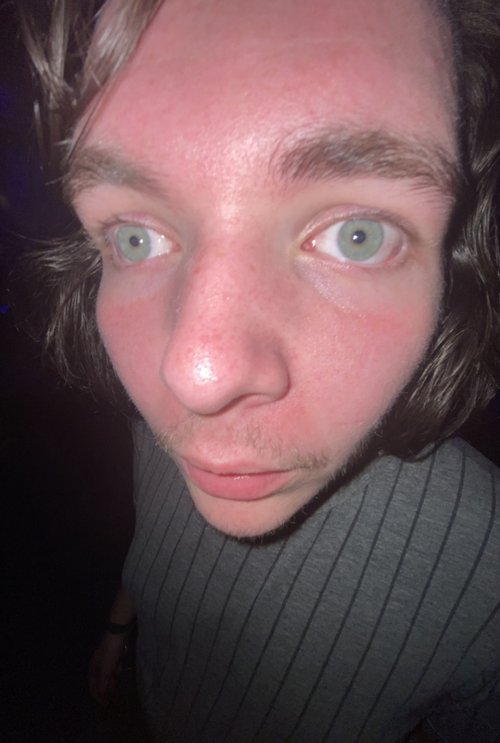 Yikes!
