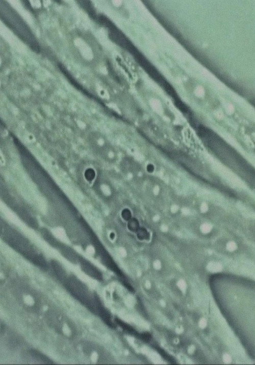 The World of Pulses - Electronics and Living Organism still 3