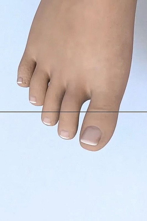 T (2017-2018)