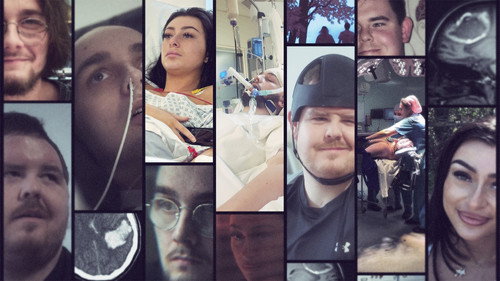 Trauma: My Broken Brain