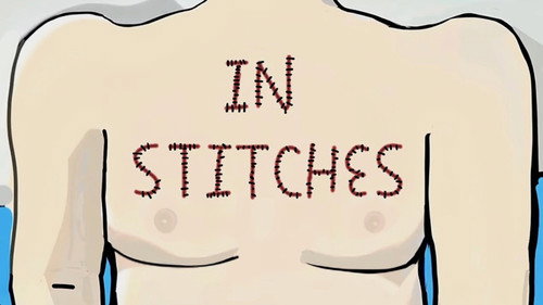 Liam Nelson - In Stitches: A Post-Op Comedy Special (How to Get Open Heart Surgery) still