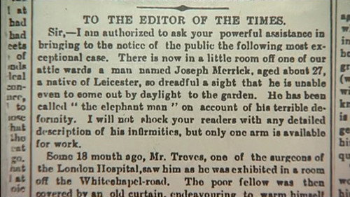 Joseph Merrick: The Real Elephant Man still