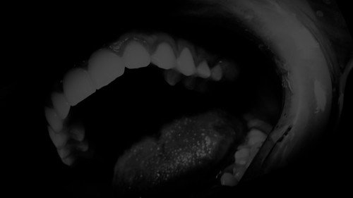 Purgatory for Epiphanea