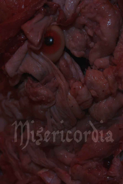 Misericordia