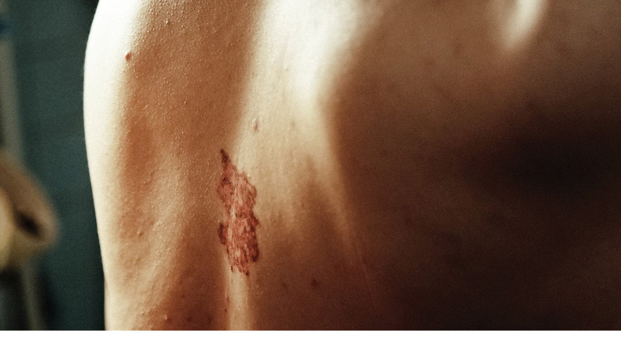 Original Wound's poster