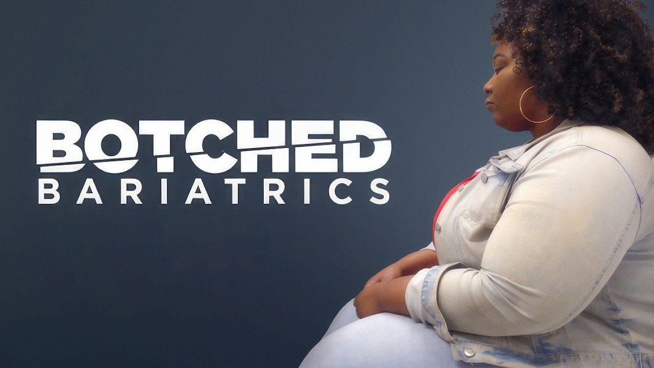 Botched Bariatrics's poster