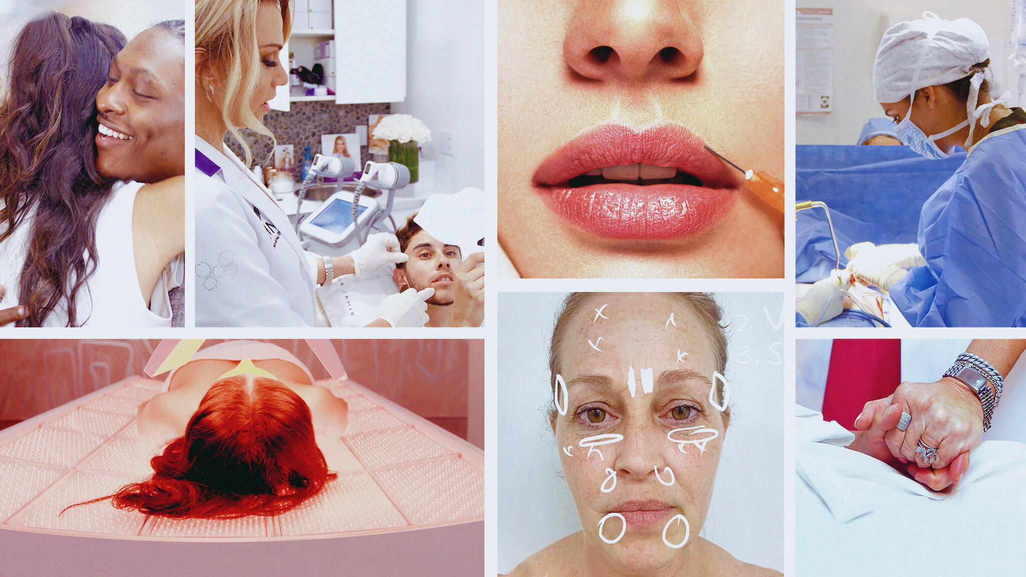 Skin Decision: Before and After's poster