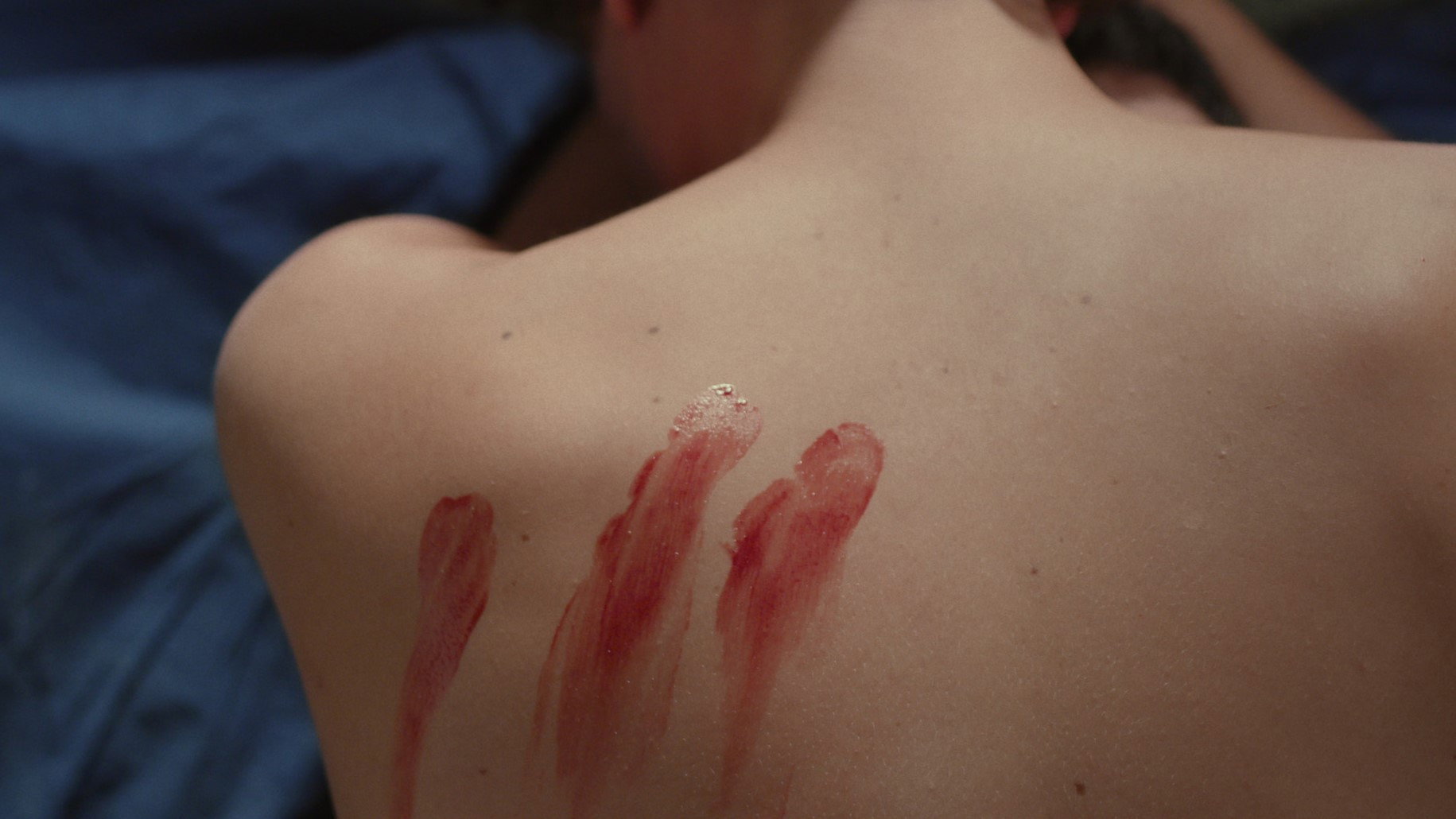 Wound's poster