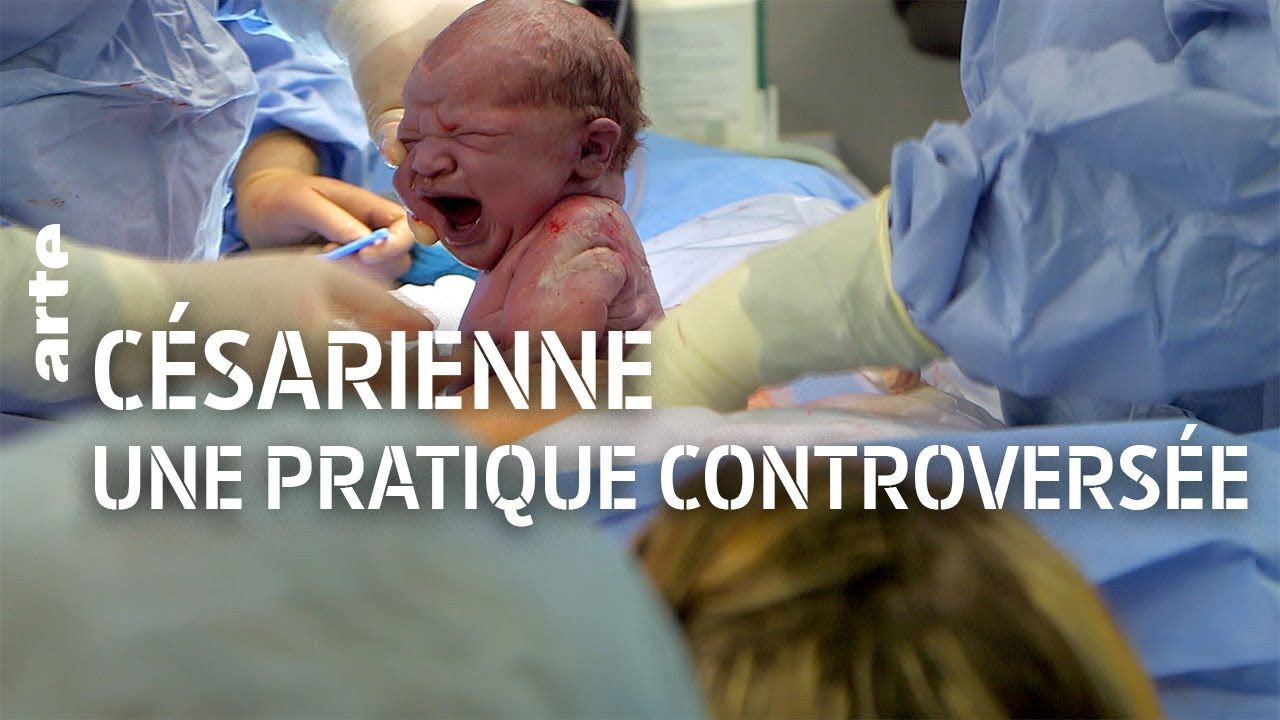 The C-Section Controversy's poster