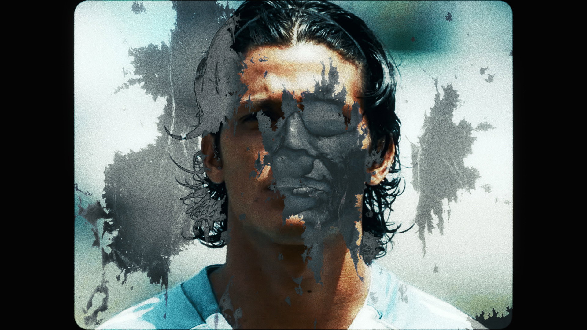 Vitiligo's poster
